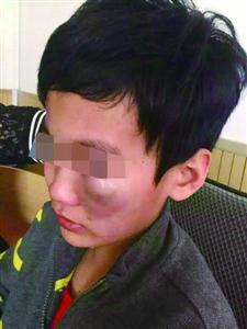 小學生逃課遭老師毆打 老師:他打罵我在先(圖)